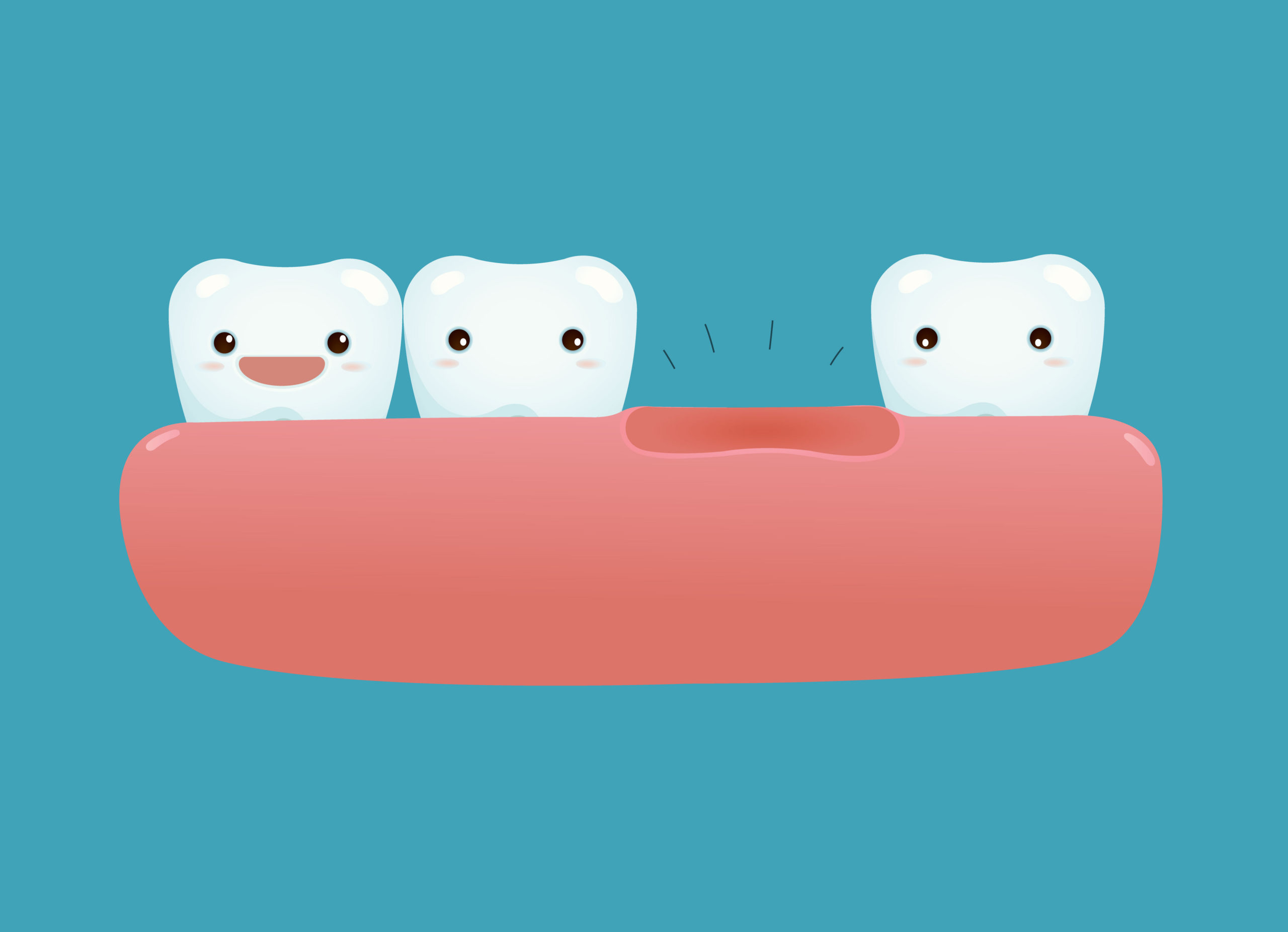Missing a tooth scaled