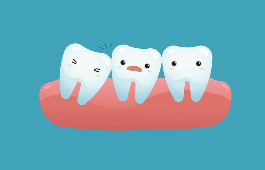 How Long Does It Take Wisdom Teeth to Grow in