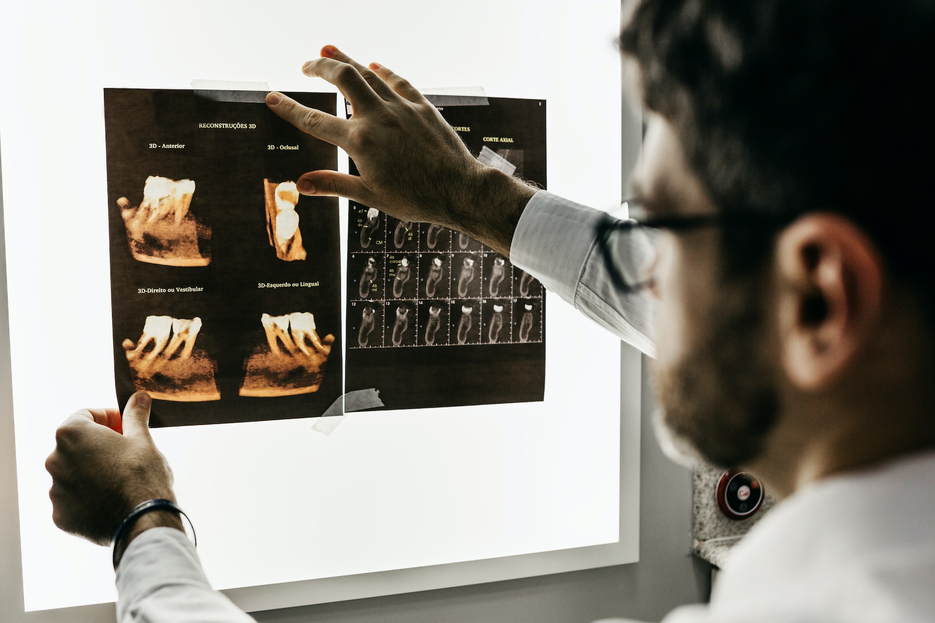 Dentist looking at teeth xray results against lightbox