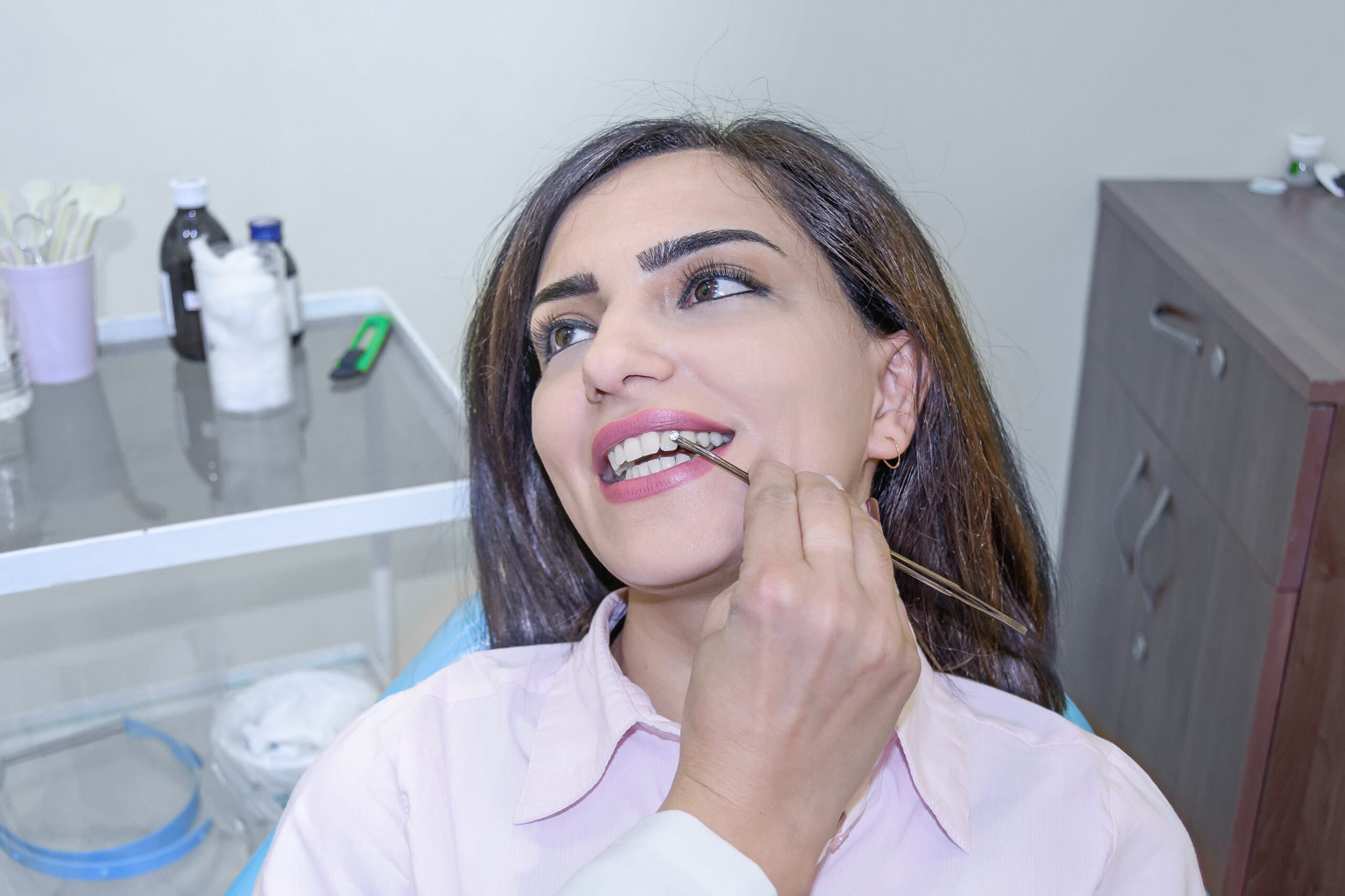 Dentist putting a tooth gem over a woman's tooth