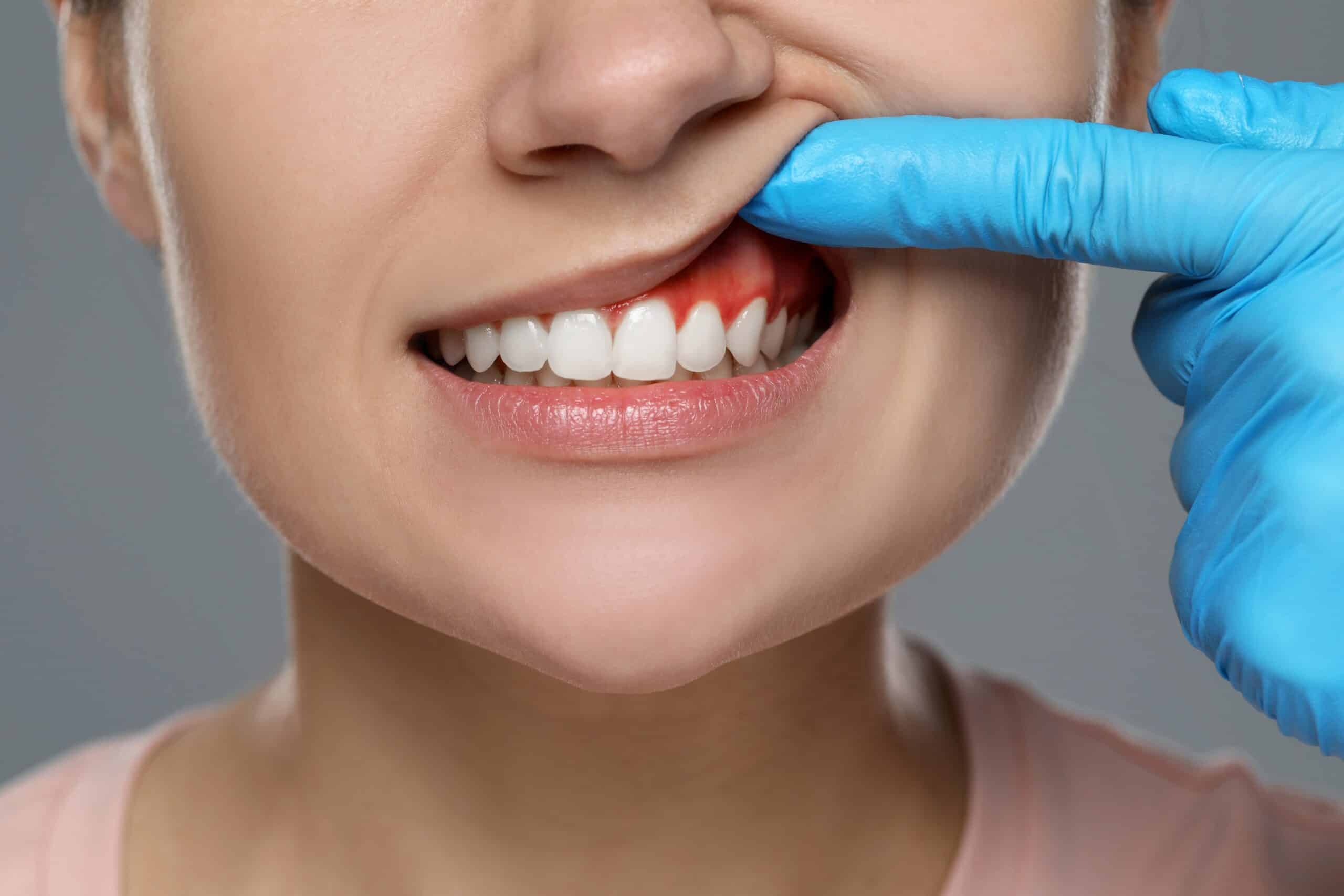 Why does the dentist poke my gums